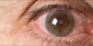 eye-300x148